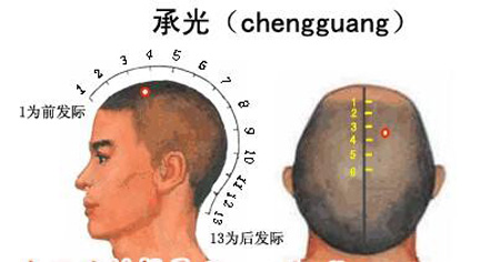 承光穴→治頭痛、鼻炎