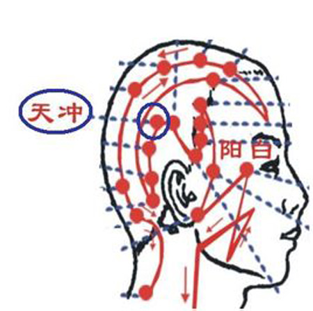 天沖穴→治頭痛、齒痛