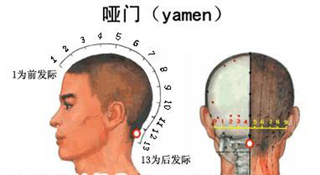 啞門穴→治音啞、頭痛