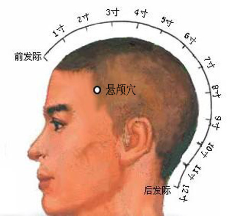 懸顱穴→治偏頭痛、面腫