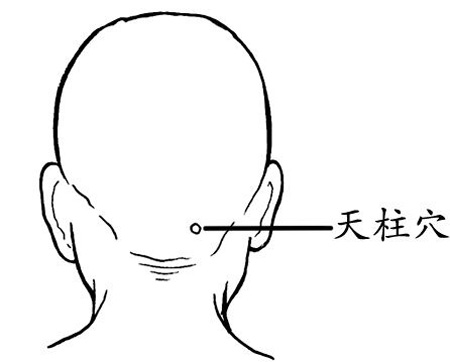 天柱穴→治頭痛、項強