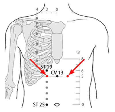 承滿穴→治胃痛、胃痙攣