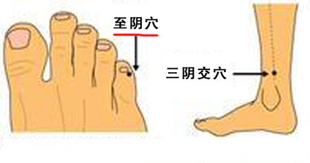 至陰穴→治頭痛、目痛