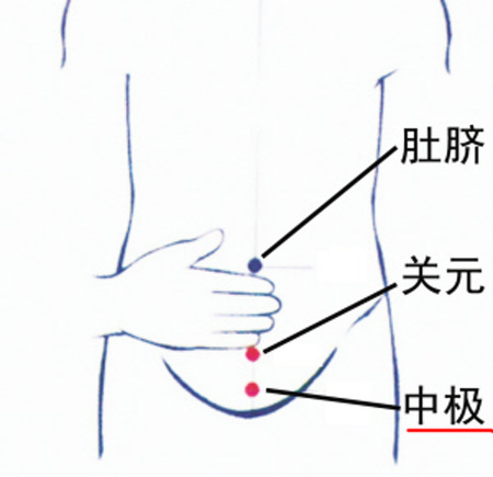 中極穴：補(bǔ)腎培元，調(diào)治陰挺、不孕