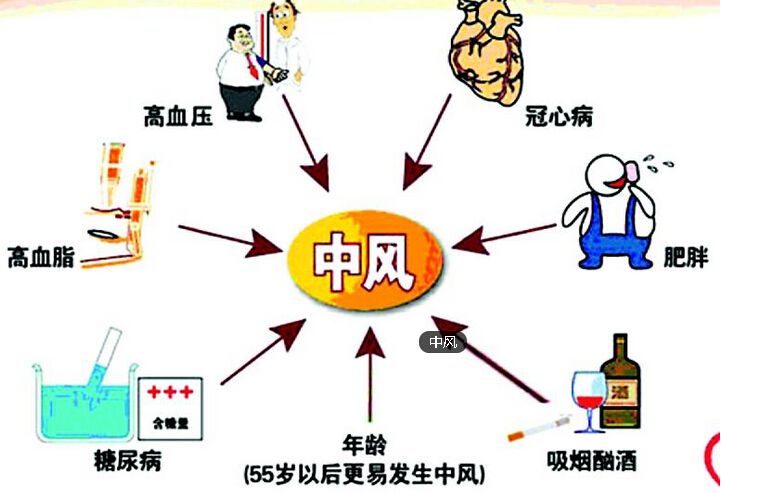 特色中醫(yī)拔罐治療中風的方法