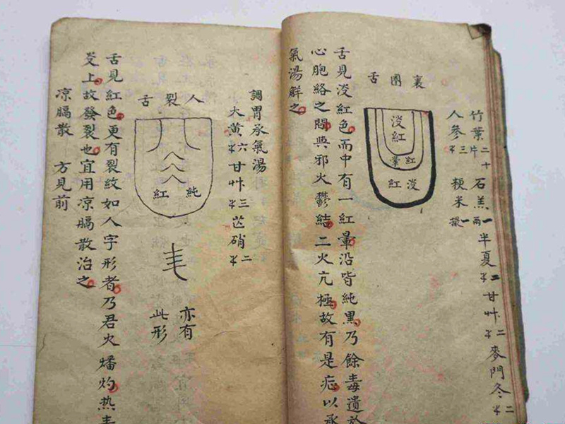 最早之舌診專書(shū)