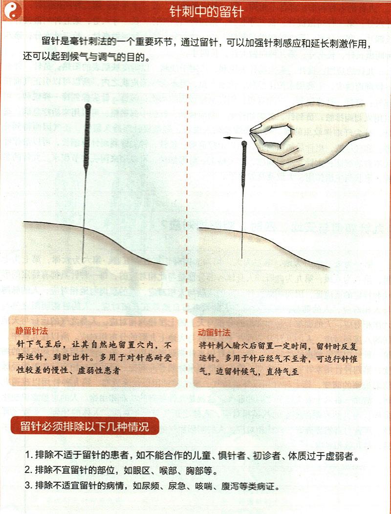 針刺穴位時(shí)有哪些需要注意的？