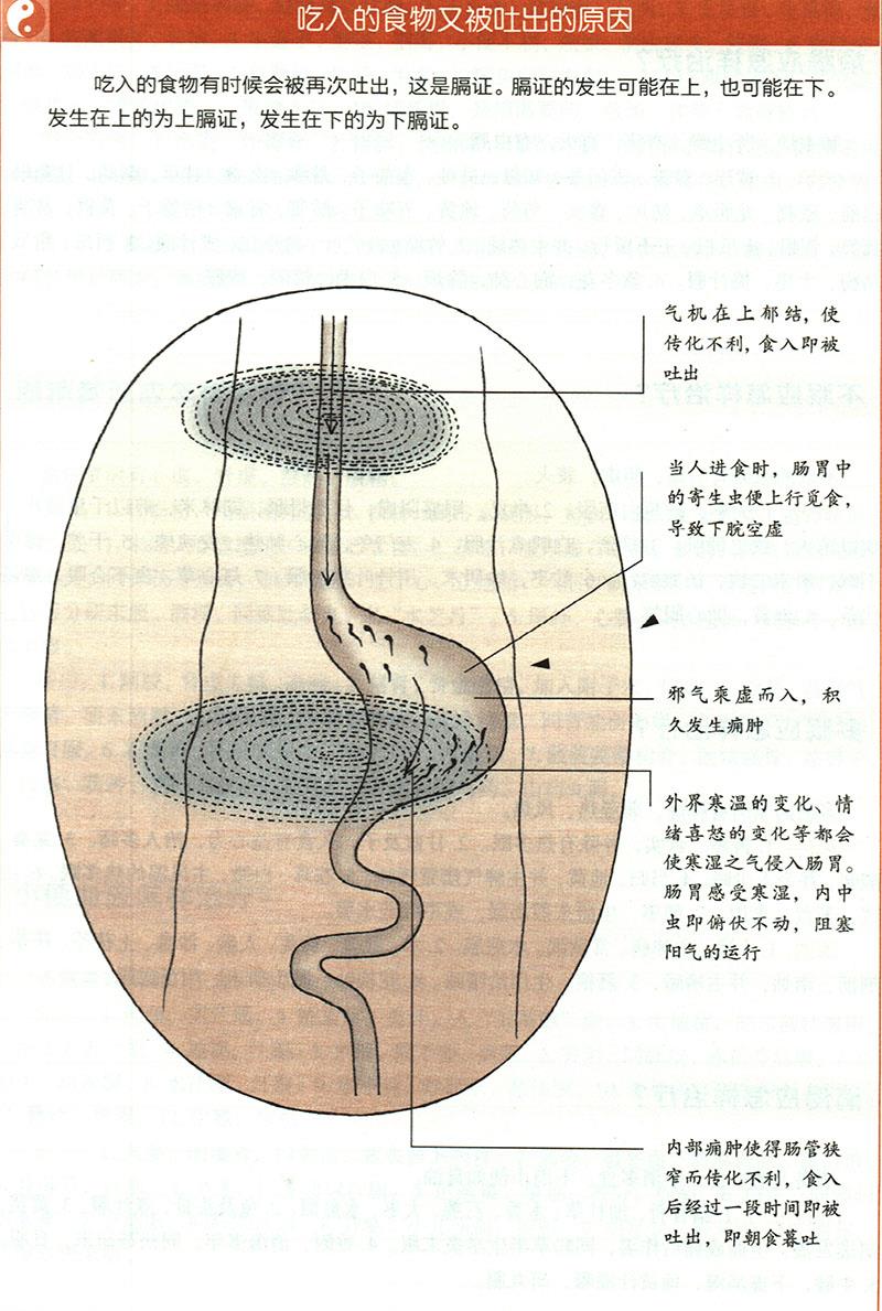 嘔吐應怎樣治療？