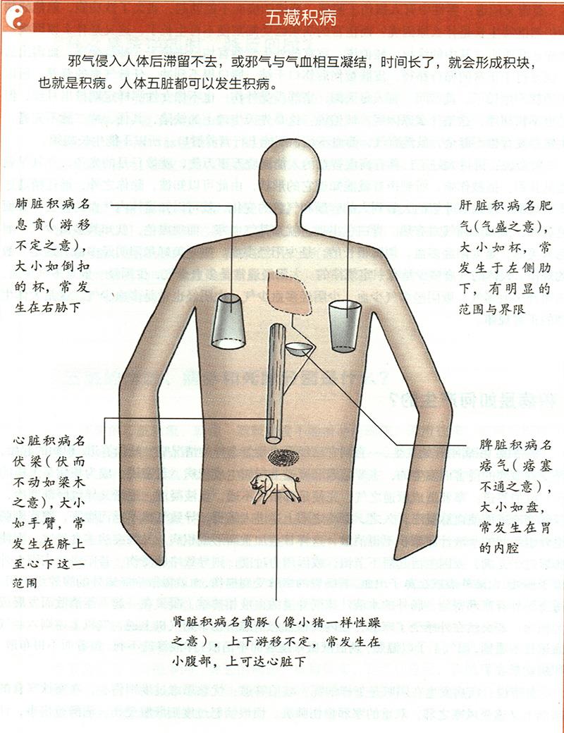 積病是如何產(chǎn)生的？